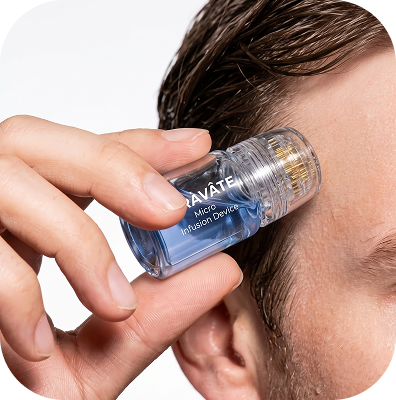 The Precision Micro-Infusion System for Advanced Scalp Care