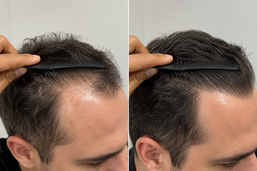 Improved crown coverage